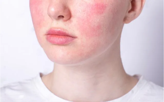 Phục hồi và tái tạo da sau treatment: Giải pháp dịu nhẹ từ mỹ phẩm sinh học Mineaderm