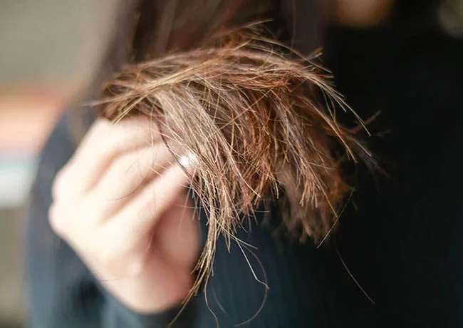 Tóc cũng bị “cháy nắng”: Dấu hiệu nhận biết và cách phục hồi chuyên sâu