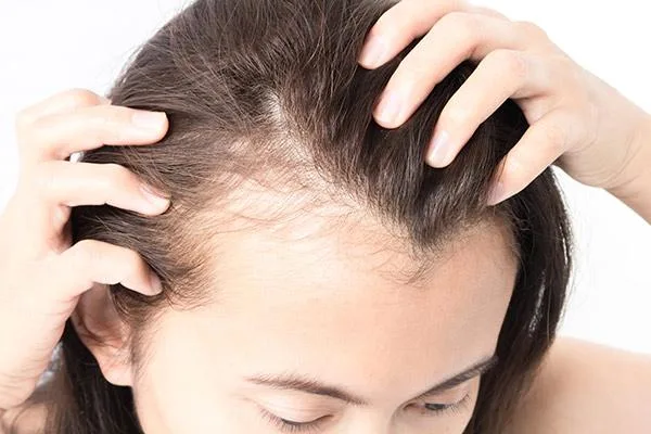 Rụng tóc theo mùa: Hiểu đúng để không hoang mang và chăm sóc hiệu quả