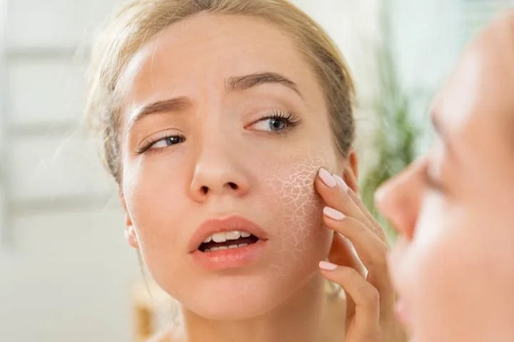 Da khô: Nguyên nhân, cách chăm sóc và gợi ý sản phẩm phục hồi hiệu quả