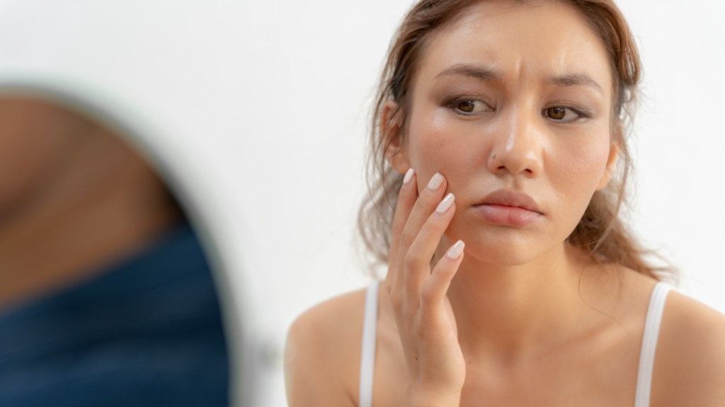 Da không đều màu: Cơ chế hình thành, nguyên nhân và giải pháp phục hồi hiệu quả